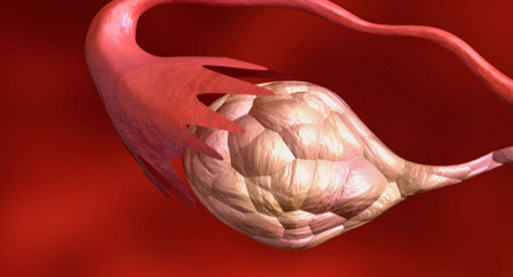 Conheça o hormônio Anti-Mulleriano e como pode prever sua reserva ovariana