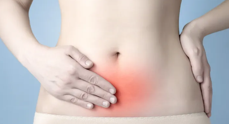 Mitos e verdades sobre a endometriose e seu tratamento