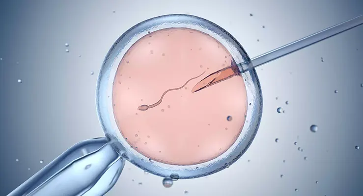 O que é fertilização in vitro e quando esse método se torna uma boa opção?
