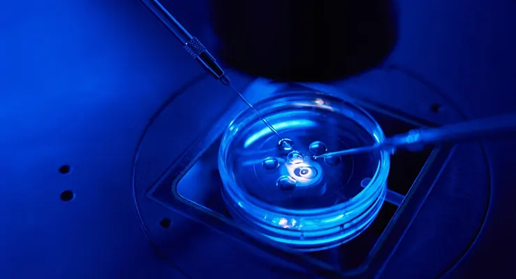 Saiba tudo sobre a injeção intracitoplasmática 
